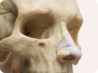 3D-CT 및 내시경 검사
