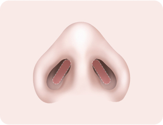 회복 및 후속 관리