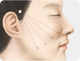상담 및 디자인