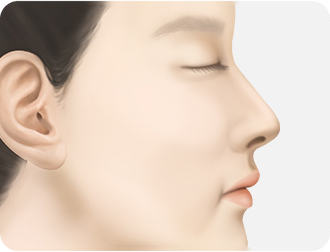 봉합 및 마무리