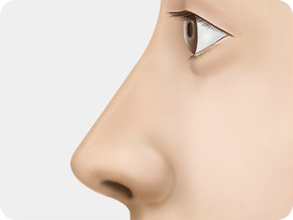 아래로 처졌던 긴코를 깔끔하게 개선