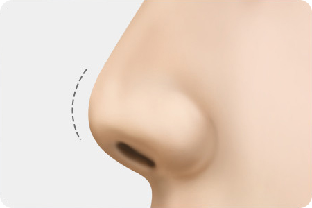 뭉툭하고 낮은 코끝