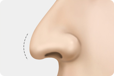 길게 내려온 코끝 (화살코)